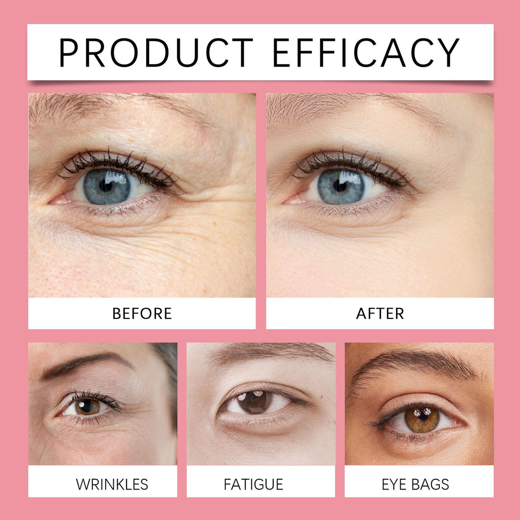 West&Month Retinol-Augencreme-Stick, strafft elastische Haut, spendet Feuchtigkeit und massiert die Haut um die Augen