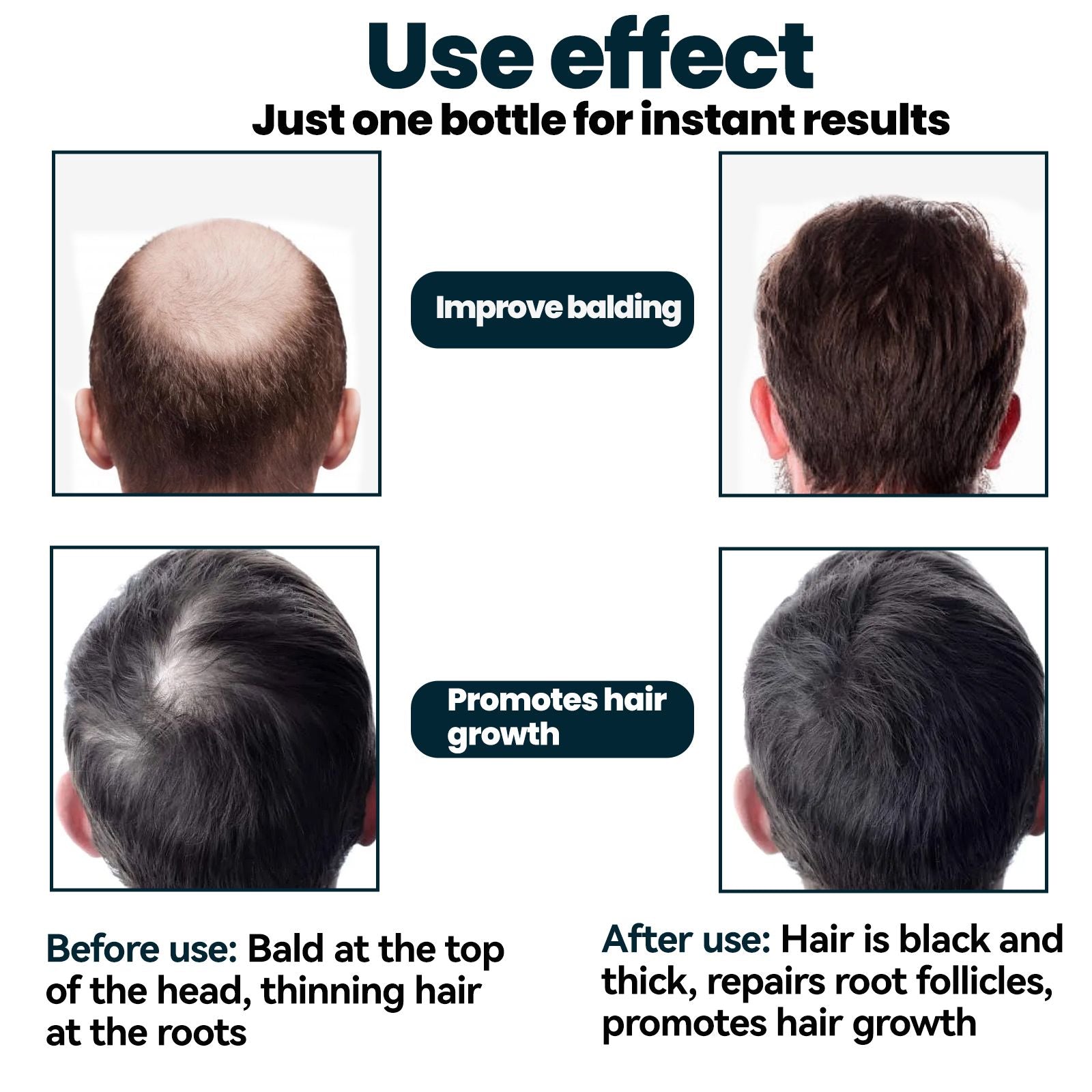 East Moon Haar Conditioner für Männer – Männer Haarpflege Ernährung und Verdickungsserum gegen Haarausfall