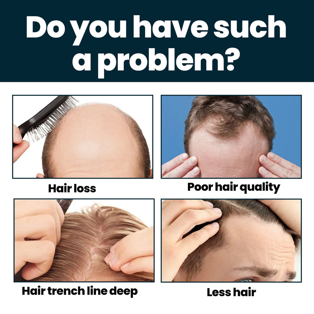 East Moon Haar Conditioner für Männer – Männer Haarpflege Ernährung und Verdickungsserum gegen Haarausfall