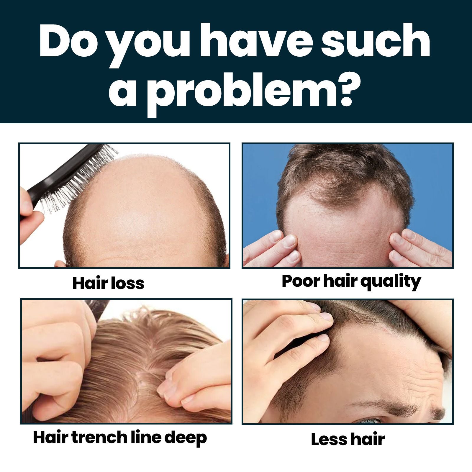 East Moon Haar Conditioner für Männer – Männer Haarpflege Ernährung und Verdickungsserum gegen Haarausfall