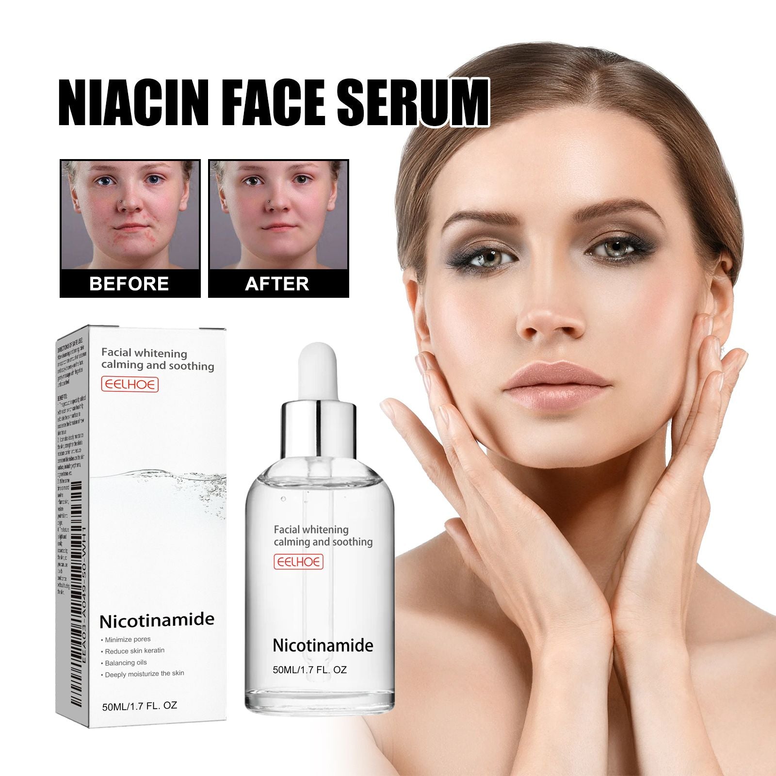 EELHOE Nicotinsäure-Gesichtsessenz zur Aufhellung von Akneflecken, Feuchtigkeit der Poren, Hautstraffung und -aufhellung – Schönheitsessenz