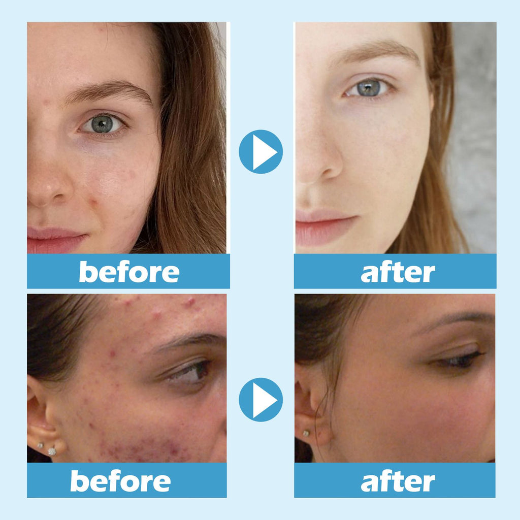 West&Month Regenerierende Schlafmaske – Reinigt Tief Poren, Befeuchtet Und Pflegt