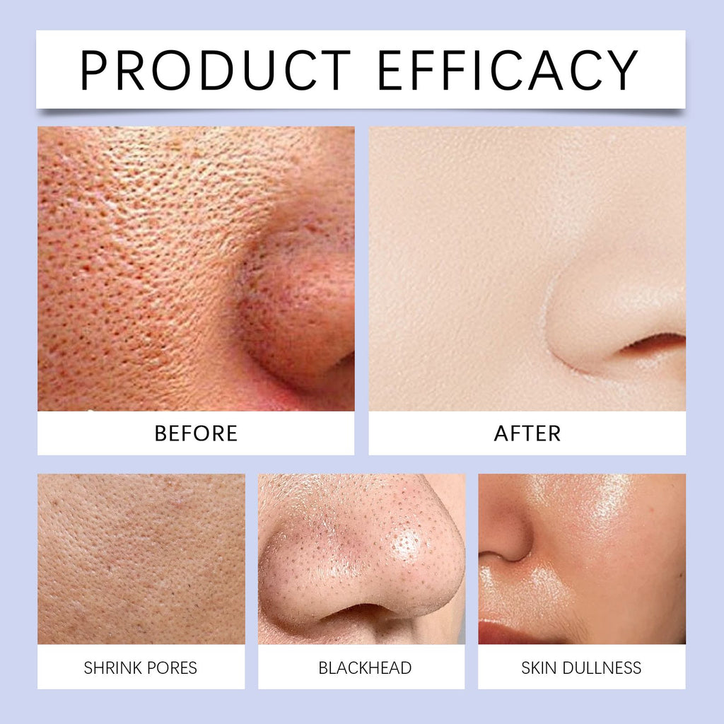 Hoygi Firming Serum Feuchtigkeitsspendendes Und Straffendes Tagespflege-Serum Für Gesichtshaut