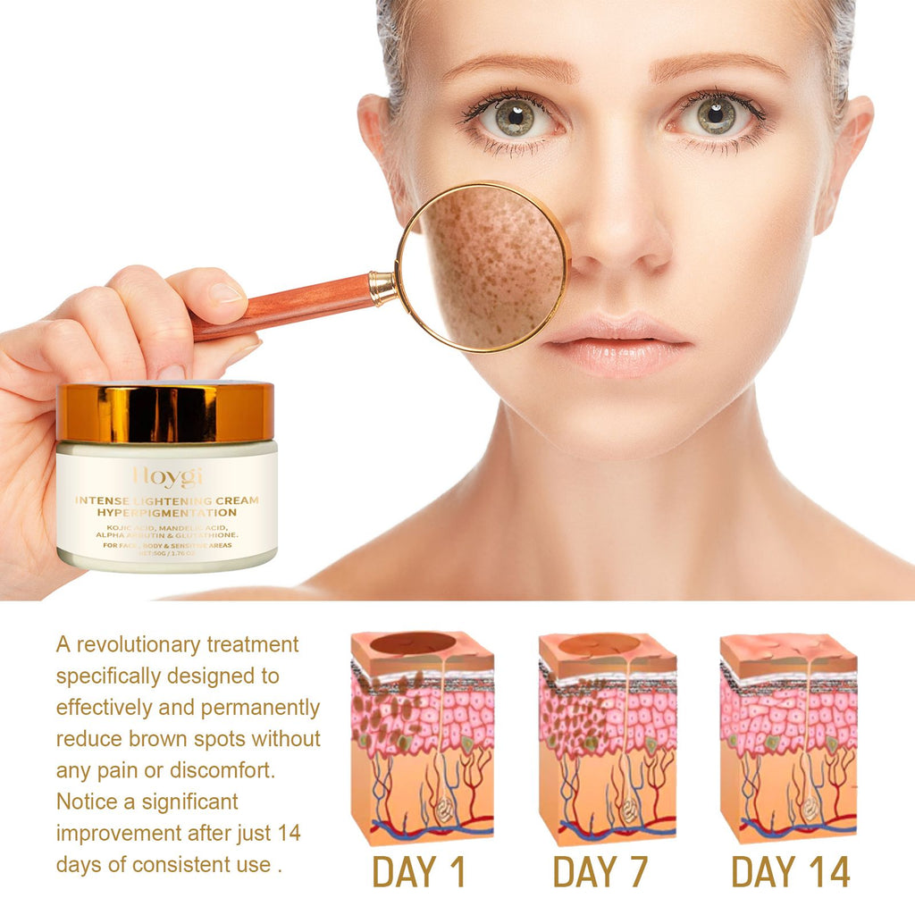 Hoygi Intensiv Aufhellende Creme, Ultra-Feuchtigkeitsspendende Festigende Strahlende Hautpflegecreme