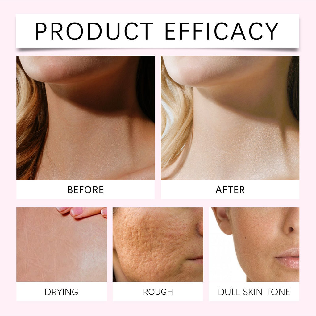 OUHOE Körperaufhellungsöl: Feuchtigkeit spendet, dunkle Stellen aufhellt, zart und rasch einziehend