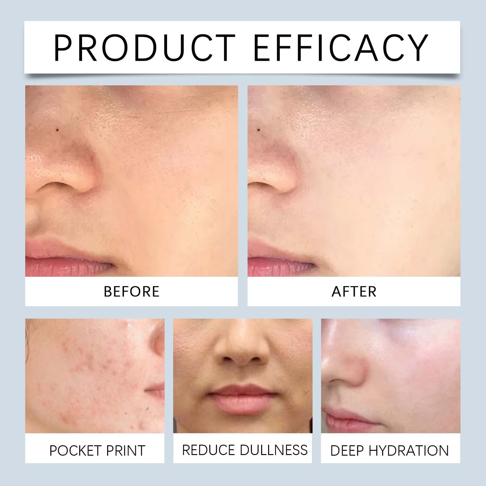 Hoygi Exfolierender Feuchtigkeitsspendender Toner, spendet Feuchtigkeit, exfoliert sanft und verbessert trockene Haut