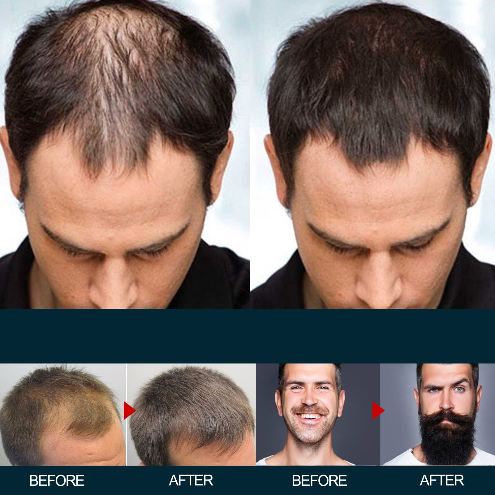 East Moon Haar Conditioner für Männer – Männer Haarpflege Ernährung und Verdickungsserum gegen Haarausfall