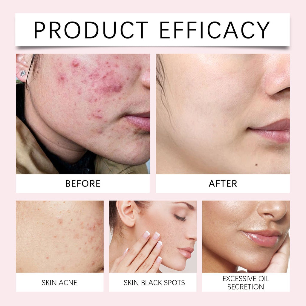 EELHOE Kurkuma-Säure Reinigungspad – Sanfte Hautreinigung, Akne-Aufhellung, Poren-Verfeinerung