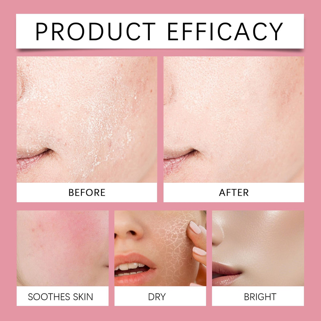 Hoygi Hyaluronsäure Aufhellende Essence (Rosa) Feuchtigkeitsspendende Tiefenpflege, Straffung und Verbesserung des Hauttons