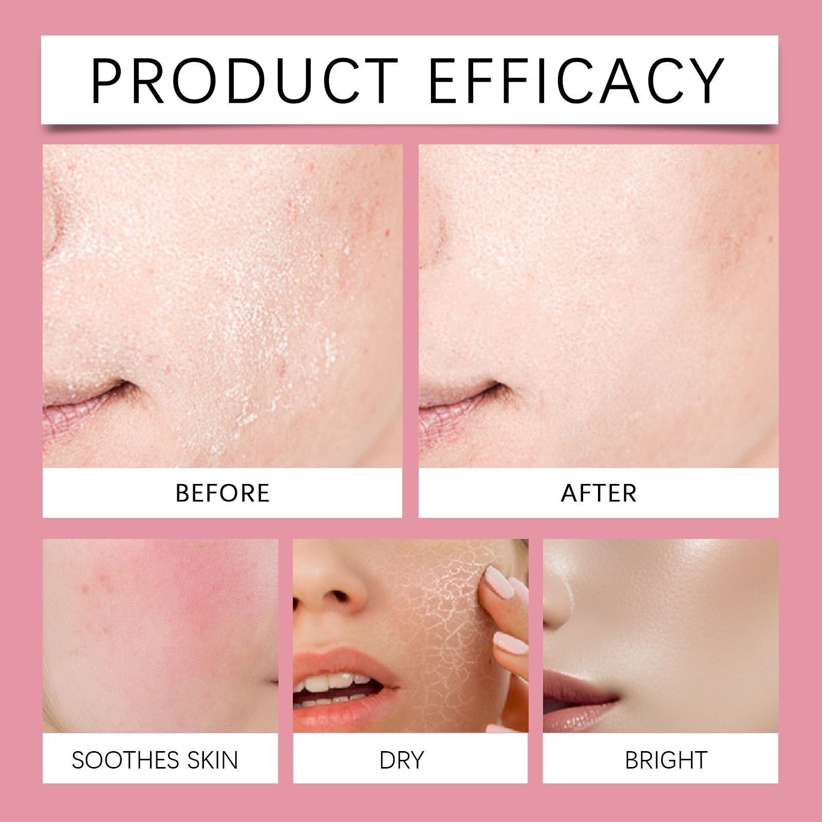 Hoygi Hyaluronsäure Aufhellende Essence (Rosa) Feuchtigkeitsspendende Tiefenpflege, Straffung und Verbesserung des Hauttons