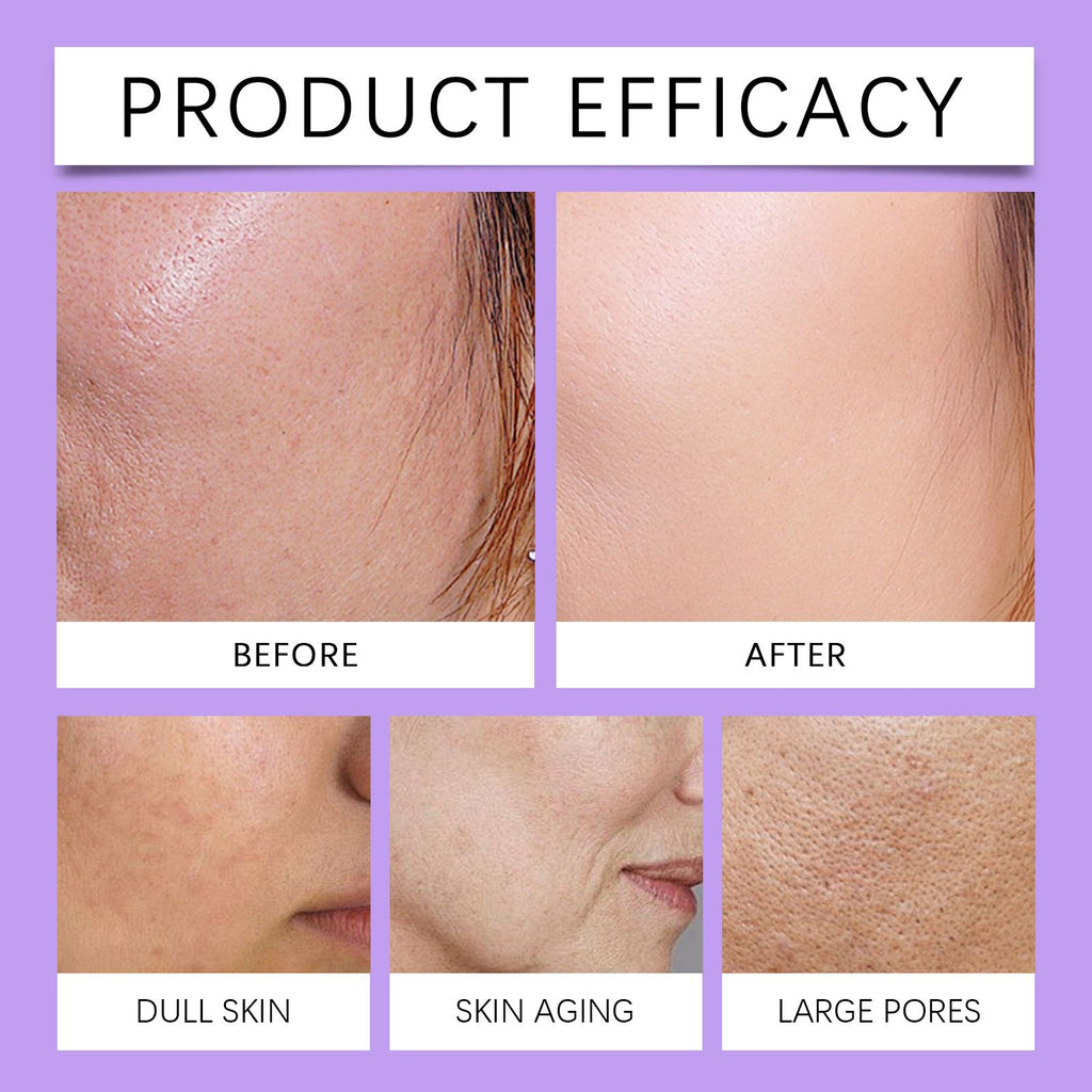 Jaysuing Gesichtsfeuchtigkeitscreme – Nährt, spendet Feuchtigkeit und pflegt die Haut, hellt sie auf und verjüngt sie täglich