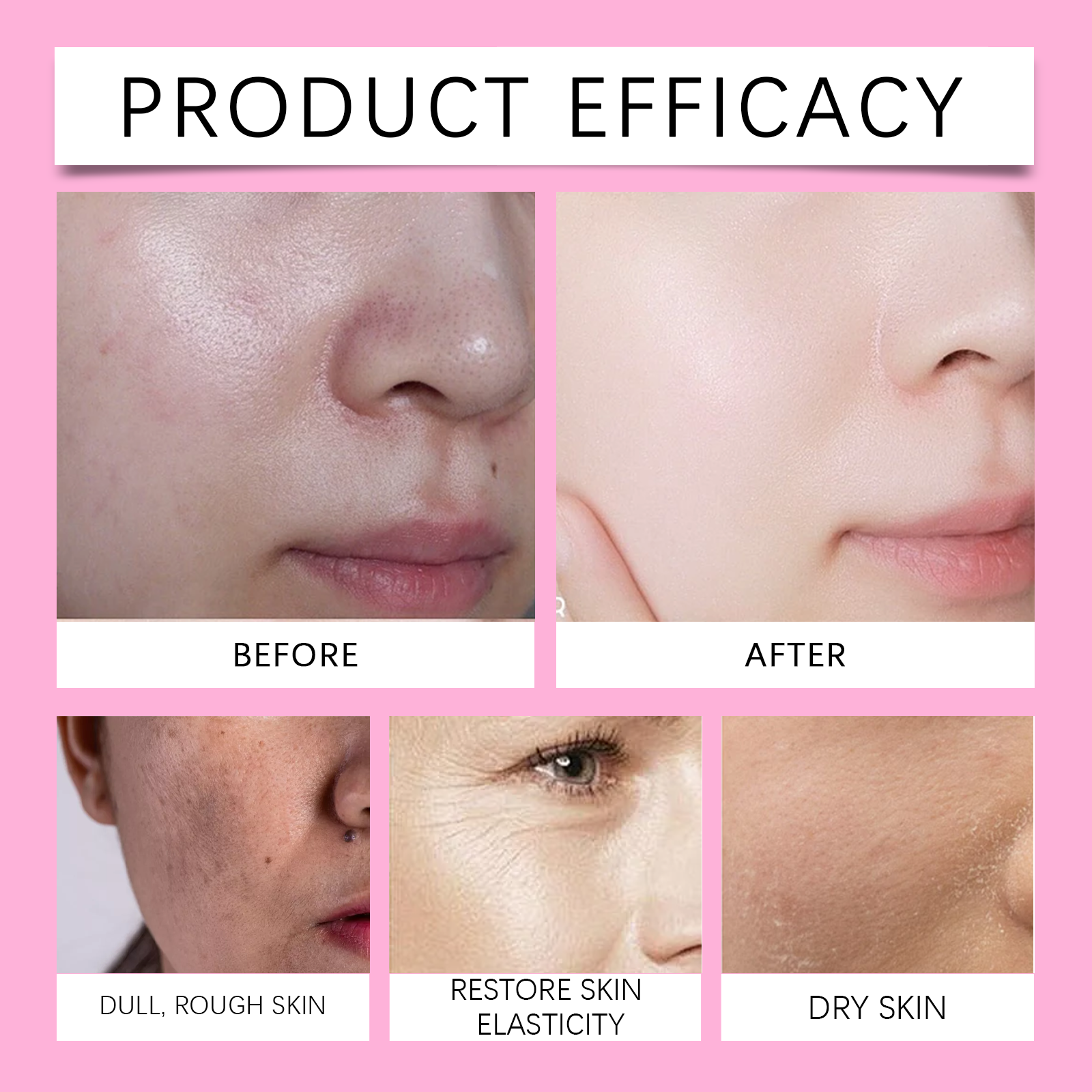 Hoygi Hyaluronsäure Aufhellende Creme, Sanfte Feuchtigkeitspflege, Straffung und Aufhellung des Hauttons