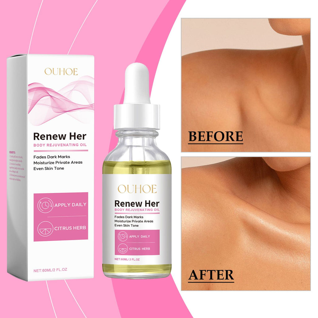 OUHOE Körperaufhellungsöl: Feuchtigkeit spendet, dunkle Stellen aufhellt, zart und rasch einziehend