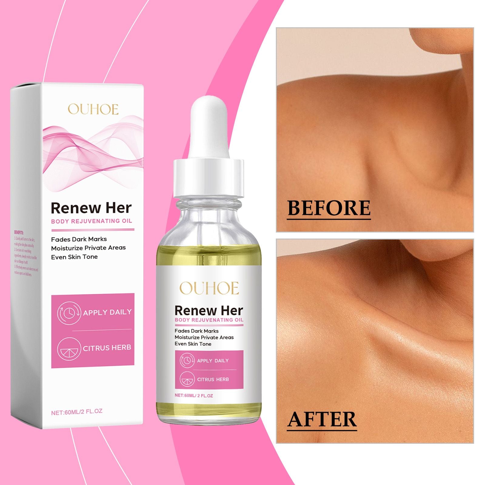 OUHOE Körperaufhellungsöl: Feuchtigkeit spendet, dunkle Stellen aufhellt, zart und rasch einziehend