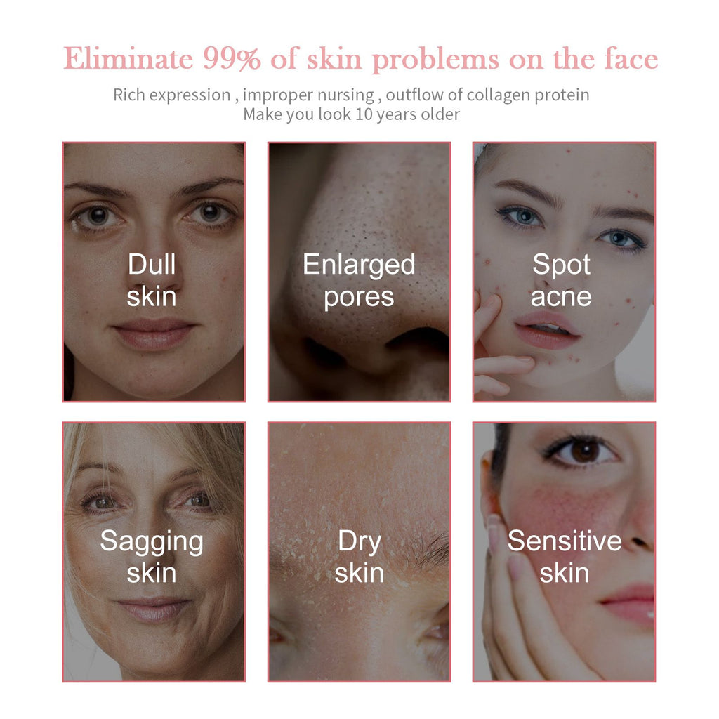 Jaysuing 5-in-1 Gesichtsfeuchtigkeitsset, Hydratisierend Und Feuchtigkeitsspendend, Tiefenhydratisierung, Aufhellung Und Straffung Der Haut